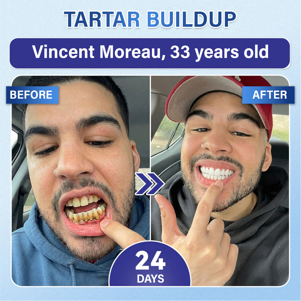 Tooth & Gum Care Fast-Dissolving Microneedle Patch