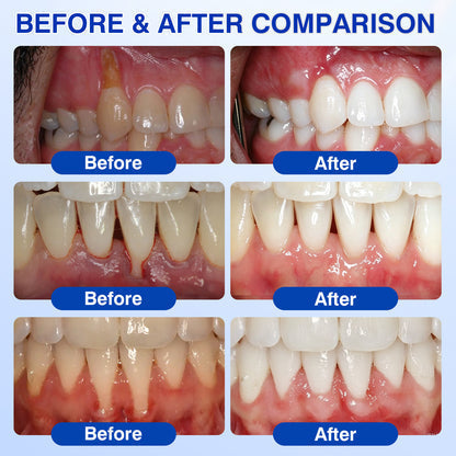 Periodontal & Gum Care Oral Gel