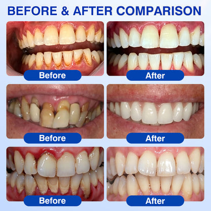 Periodontal Gum Care Gel