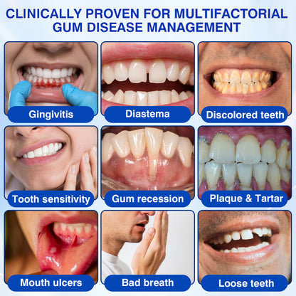 Periodontal & Gum Care Oral Gel